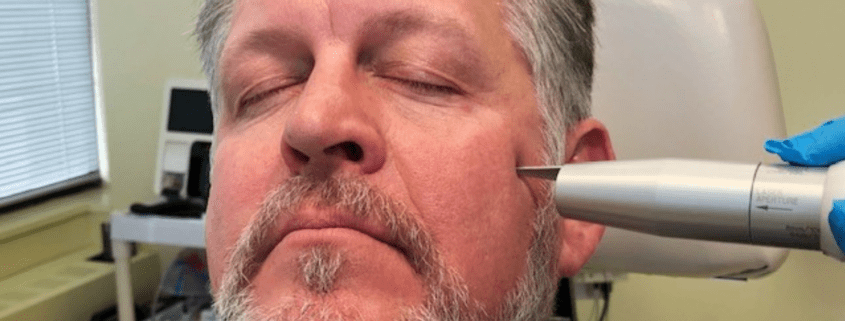 facial rejuvenation for men